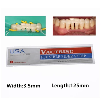 Zubné Sklenené Vlákna, Závlačky Svetlo Liek Kompozitné Živice Lepenie Pásov Ortodontická Držiak 3.5mmX125mm